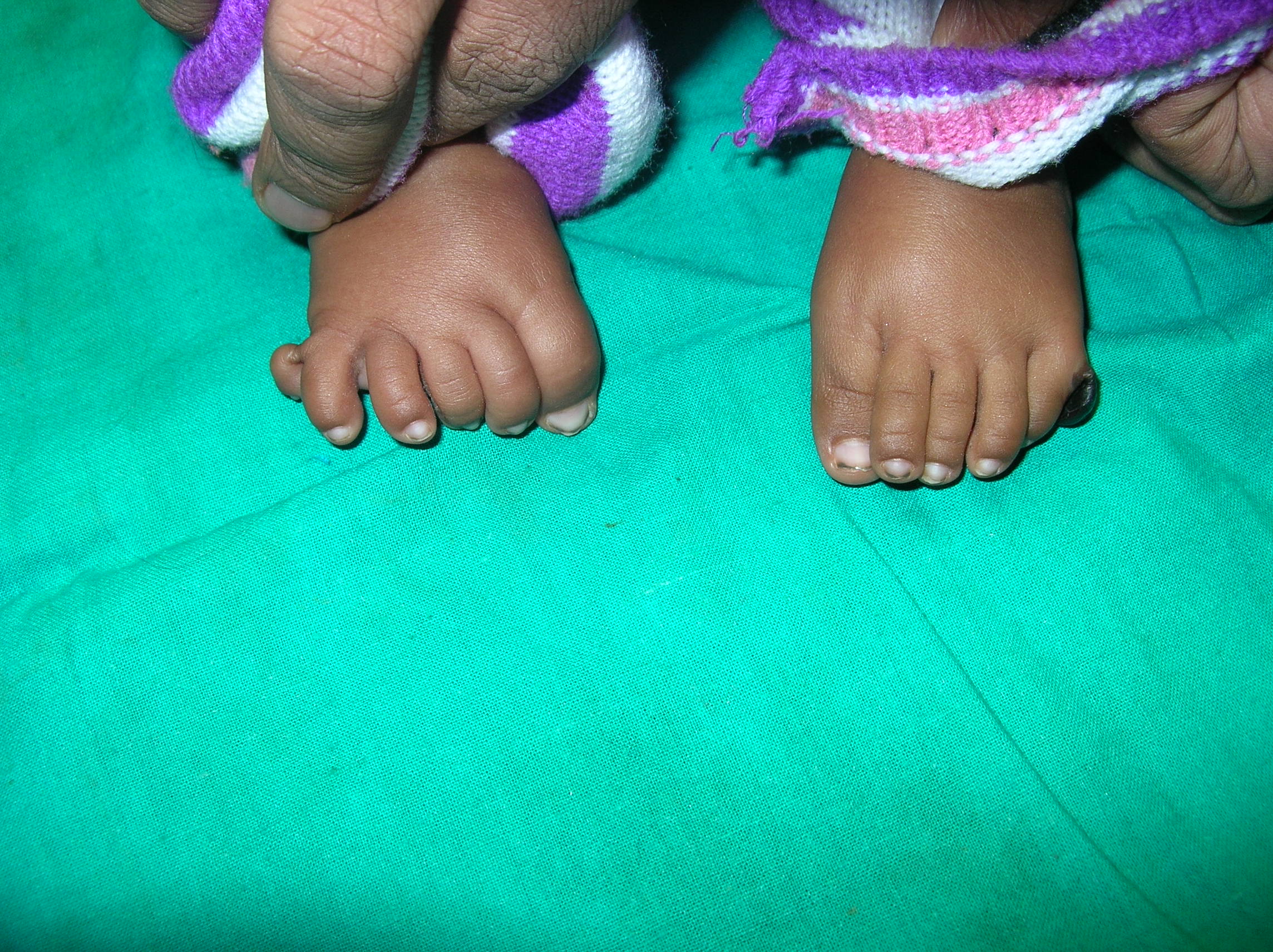 Pediatric Plastic Surgery Image 6
